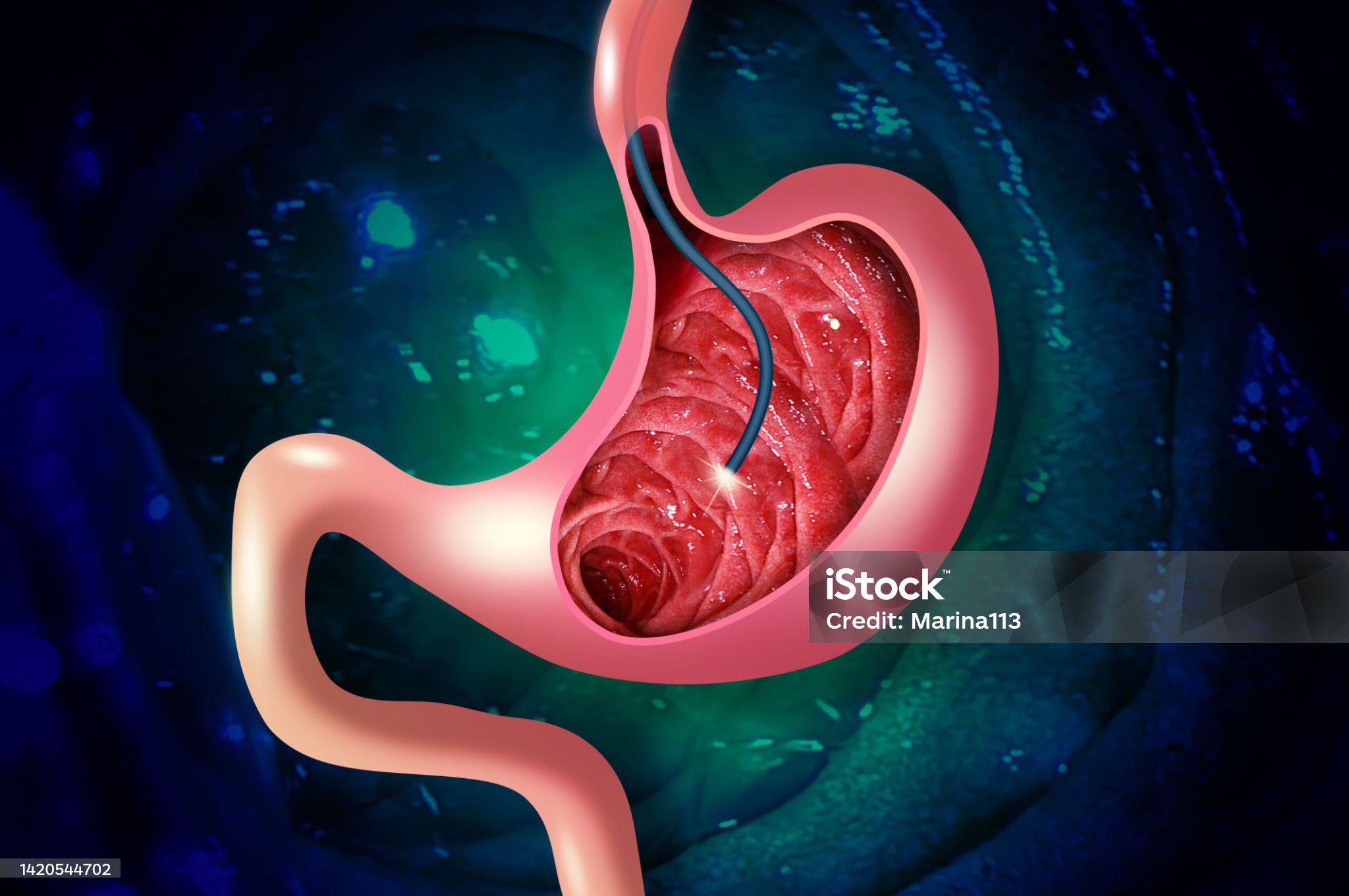 GASTRO-ENTÉROLOGIE
